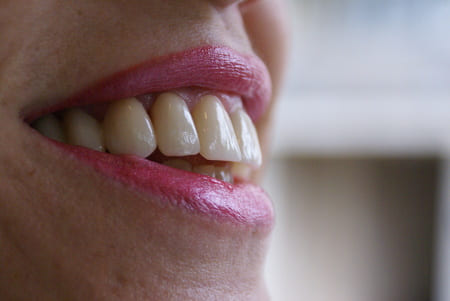 Parodontologija Crnojević Dental Studio